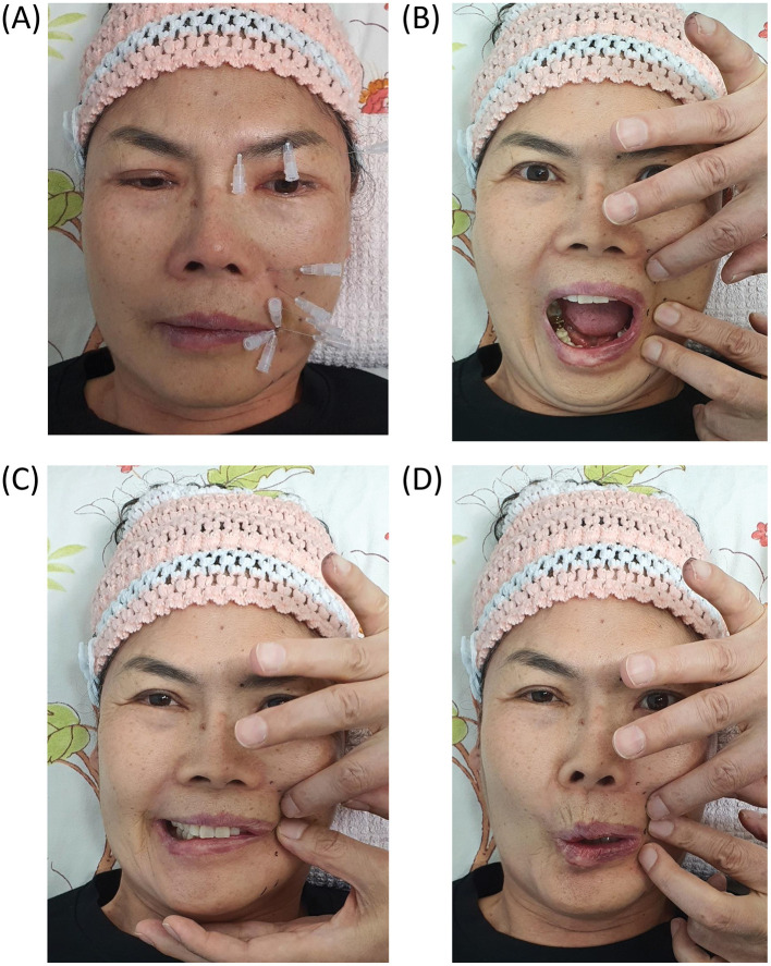 Figure 4