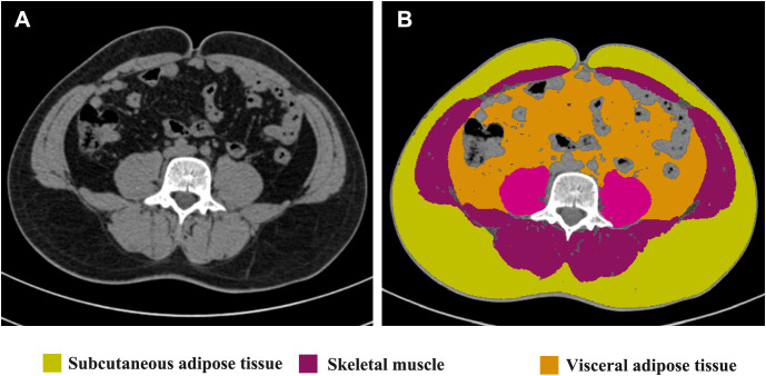 Figure 1