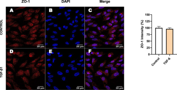 Figure 33