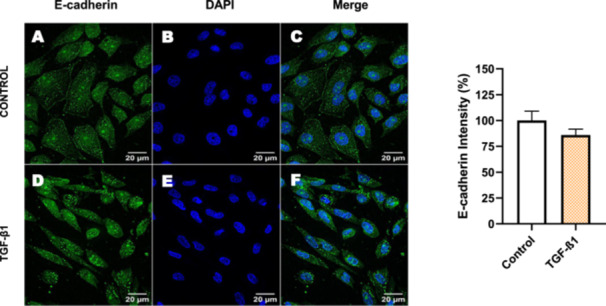 Figure 30