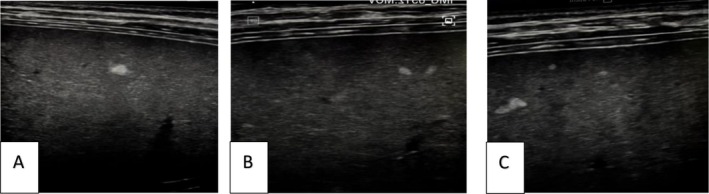 FIGURE 1