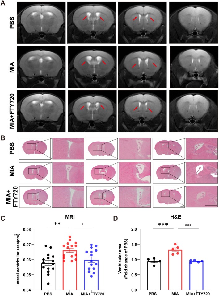 FIGURE 3