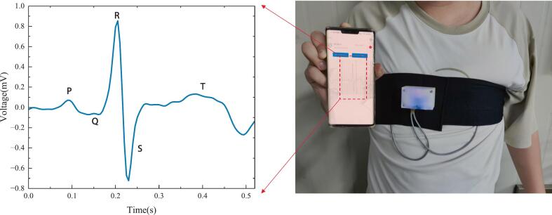 Figure 23