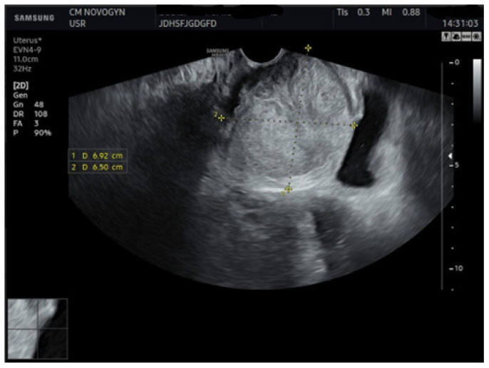 Figure 1