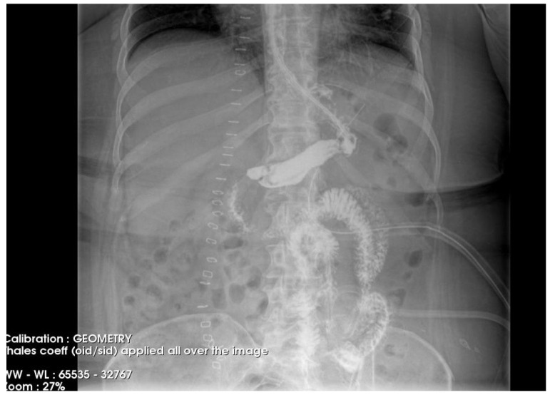 Figure 4