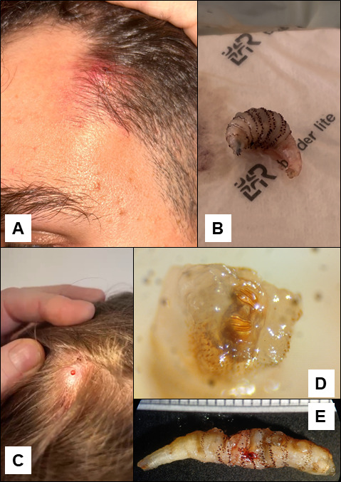 Fig 1