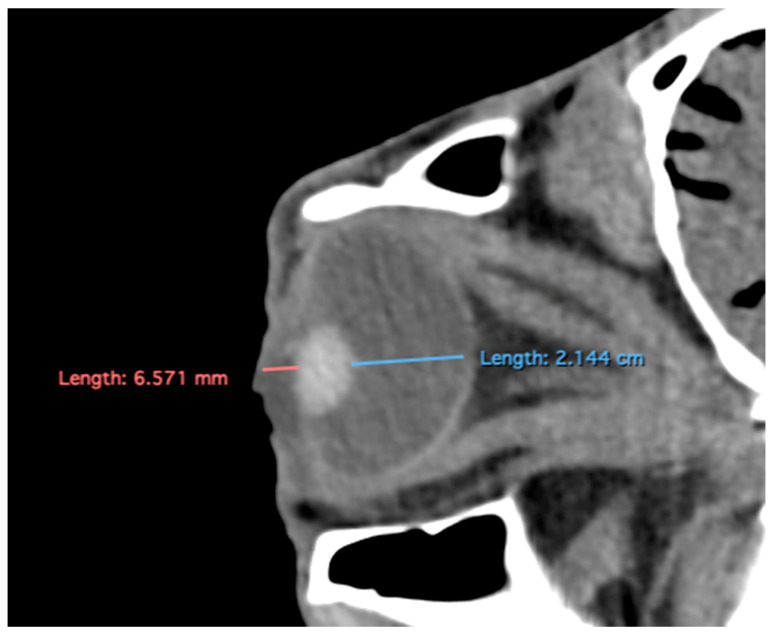 Figure 5