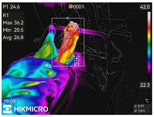 Figure 6