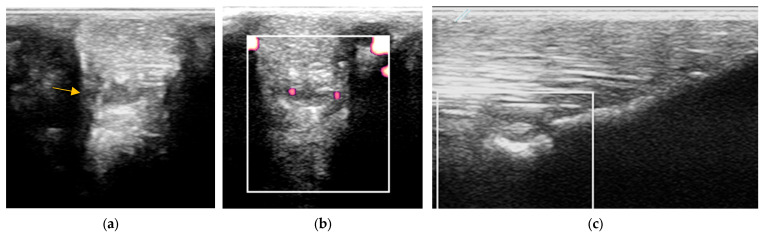 Figure 12