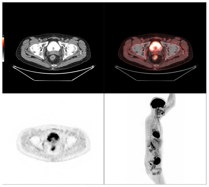 Figure 10