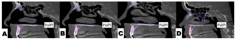 Figure 10