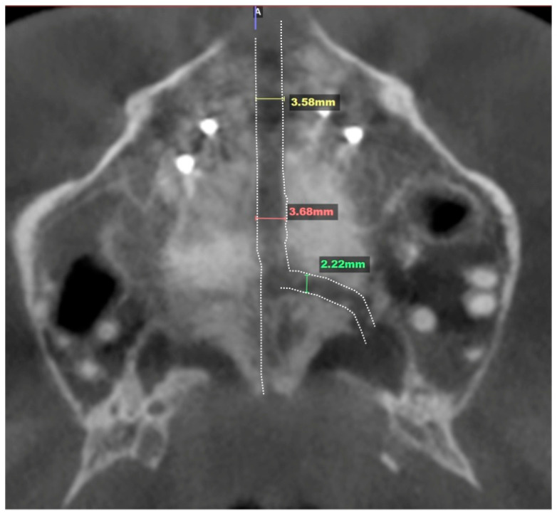 Figure 12