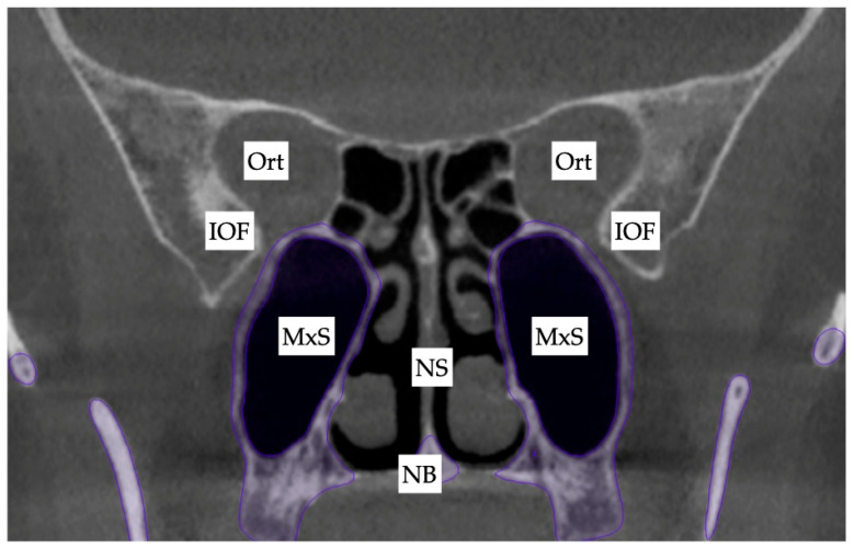 Figure 13