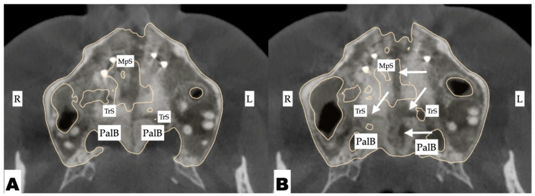 Figure 15