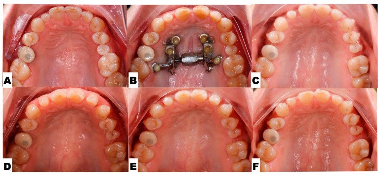 Figure 16