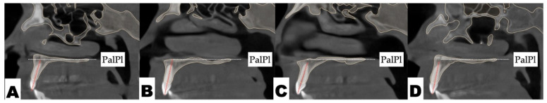 Figure 17