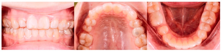 Figure 18
