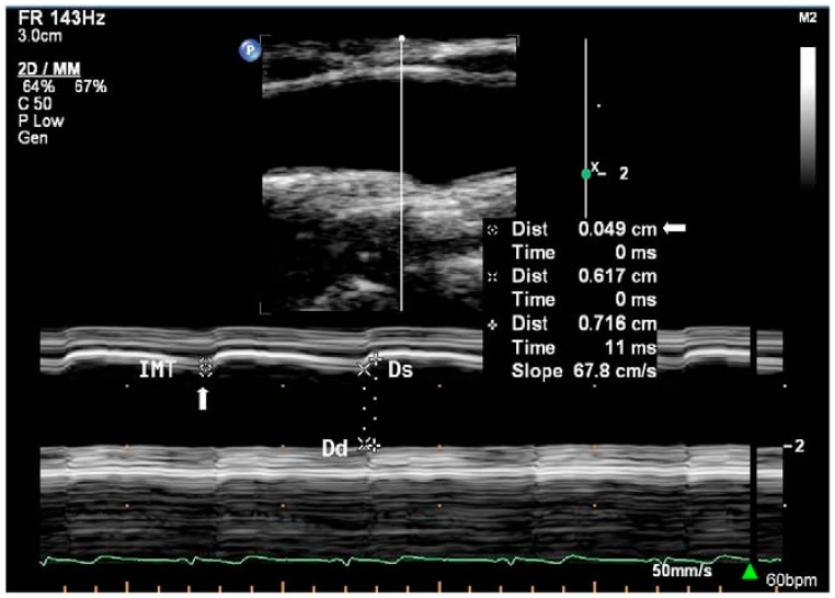 Figure 2