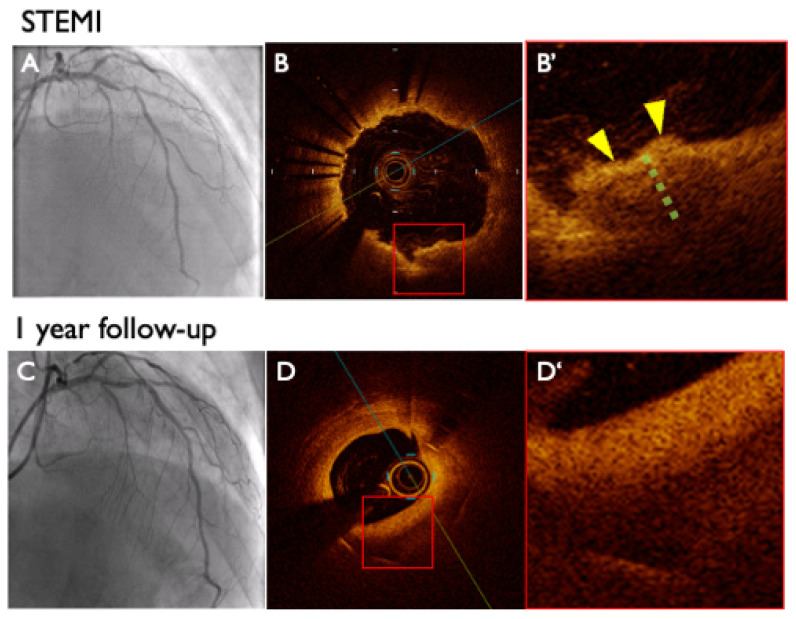 Figure 4