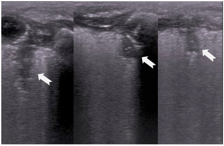 Figure 15