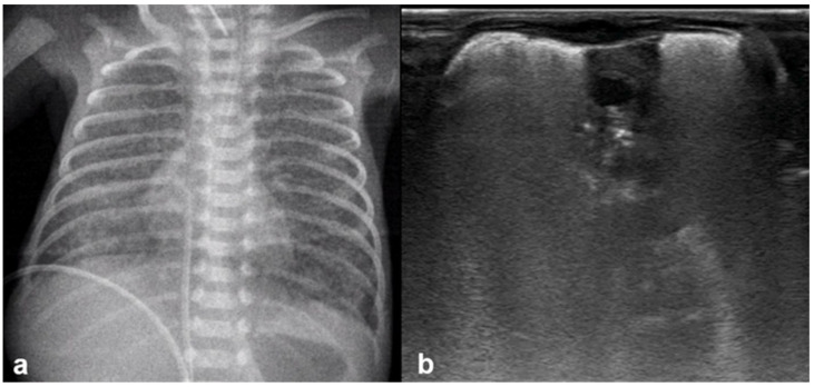 Figure 16