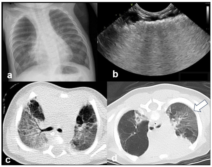 Figure 19