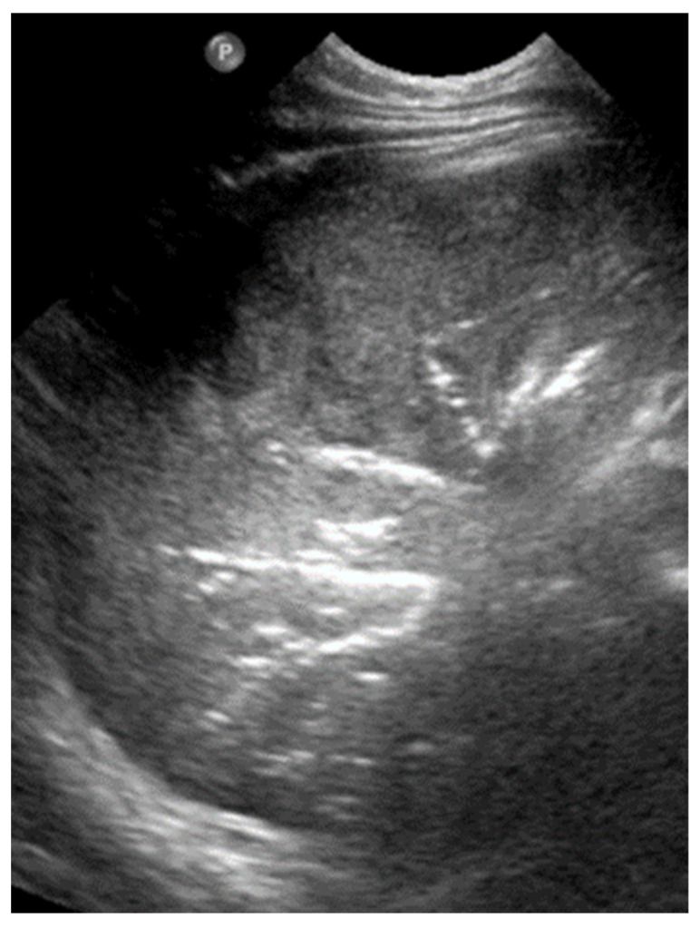 Figure 20