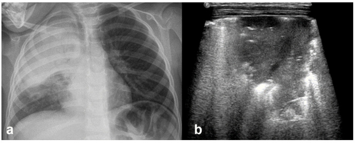 Figure 21
