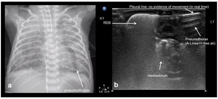 Figure 22
