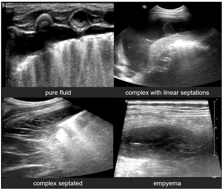 Figure 23