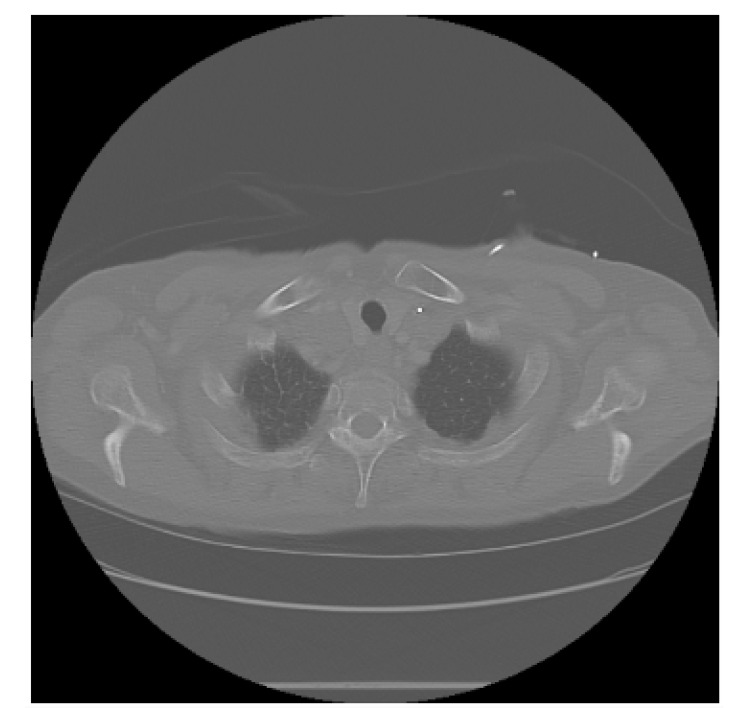 Figure 6