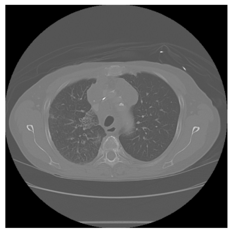 Figure 10
