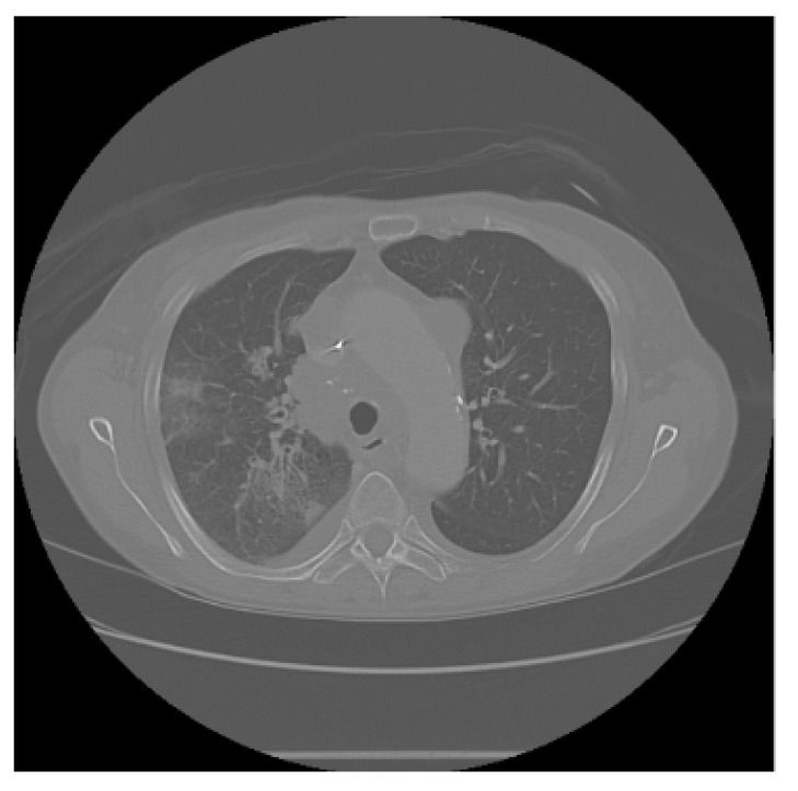 Figure 11