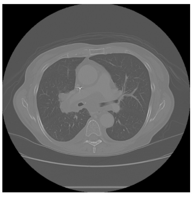 Figure 12