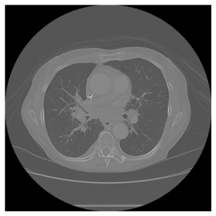 Figure 13