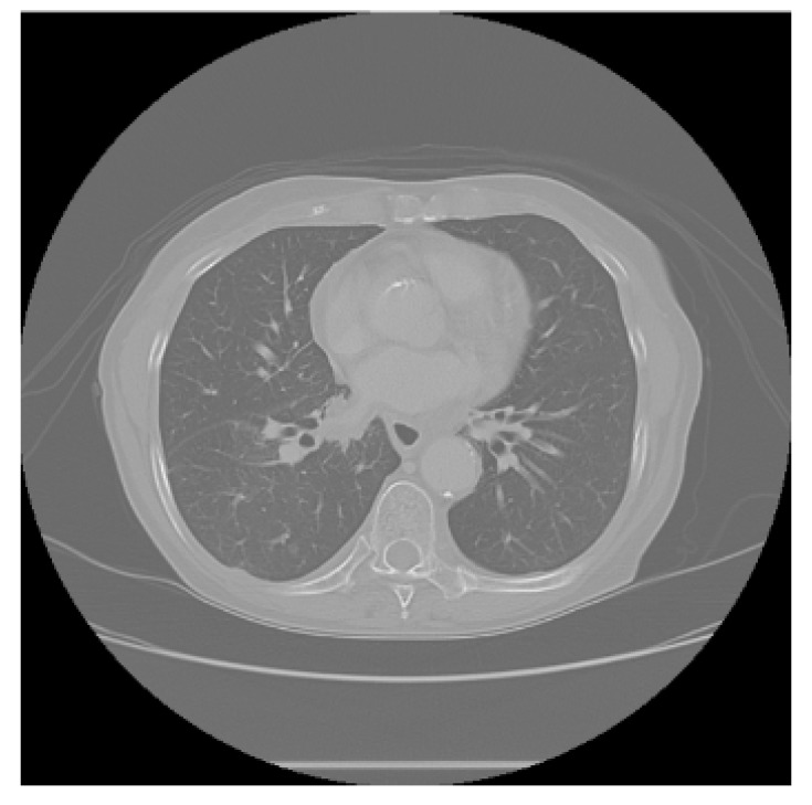 Figure 14