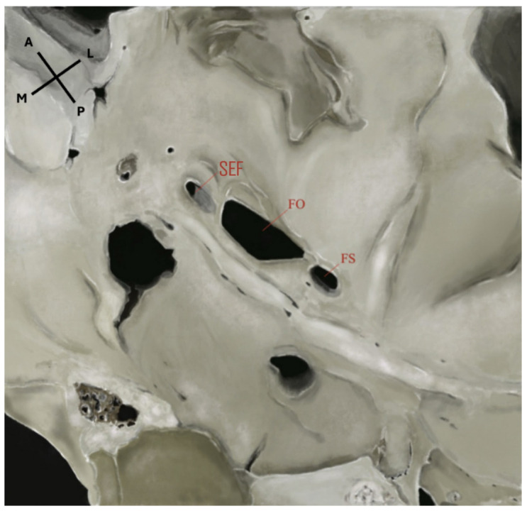 Figure 2