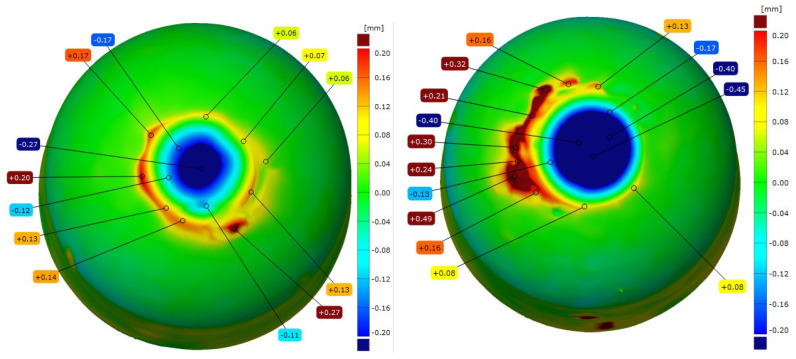 Figure 11
