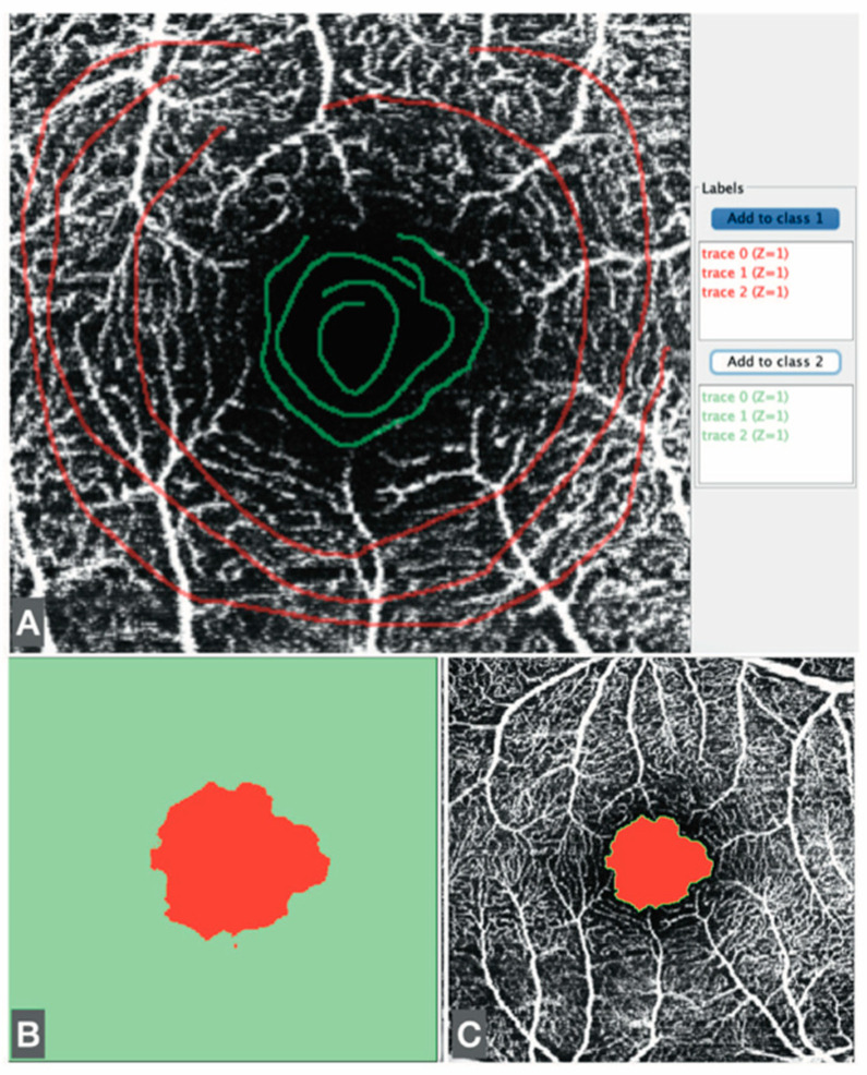 Figure 2