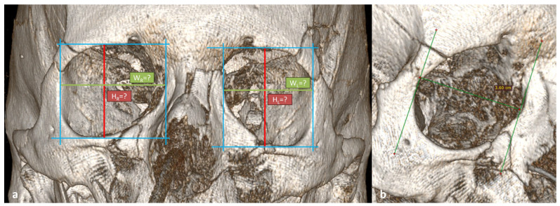 Figure 9