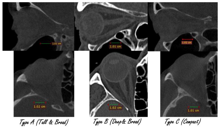 Figure 10
