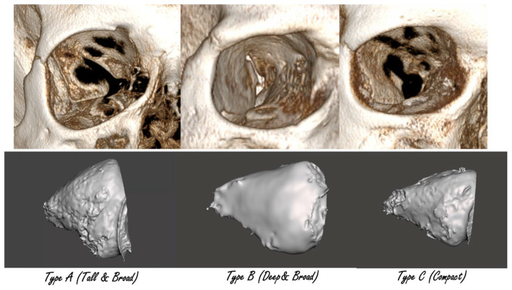 Figure 11