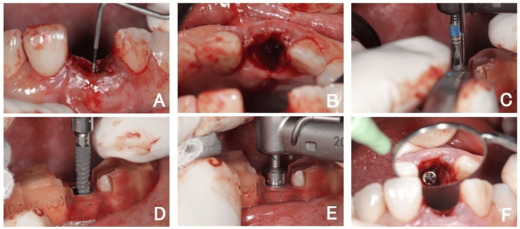 Figure 6