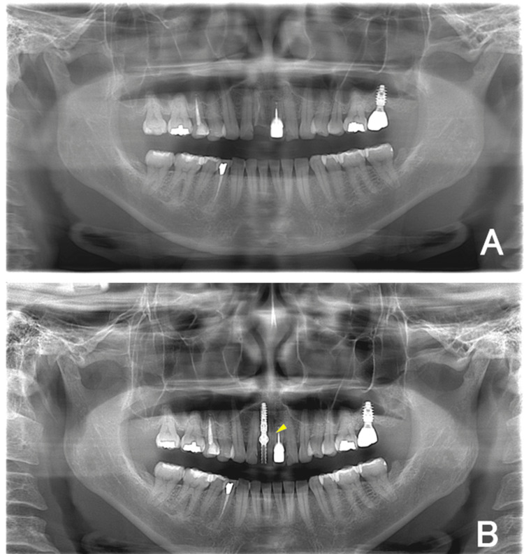 Figure 9