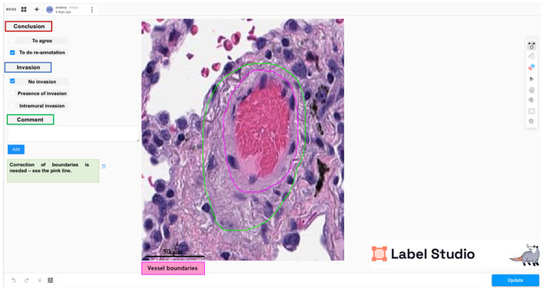 Figure 16