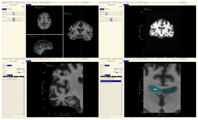 Figure 30