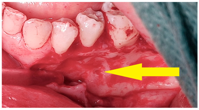 Figure 12