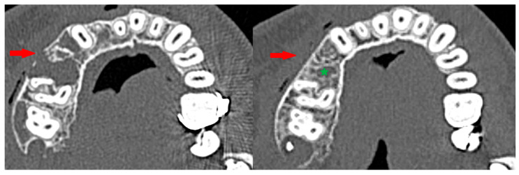 Figure 13