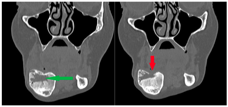 Figure 14