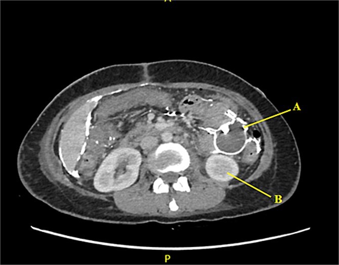Figure 4